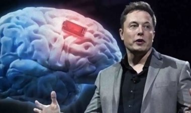 મસ્કની કંપનીએ માણસના મગજમાં લગાવી ચિપ! જાણો કેટલી છે સાઈઝ